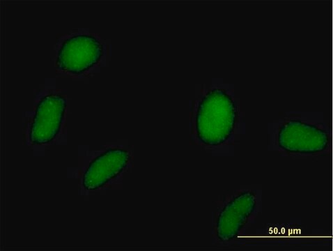 Anti-SPOP antibody produced in mouse purified immunoglobulin, buffered aqueous solution