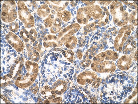 Anti-ENO3 (AB2) antibody produced in rabbit IgG fraction of antiserum