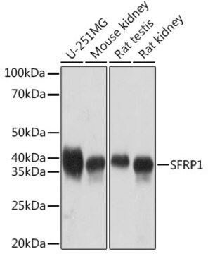 Anti-SFRP1 Antibody, clone 5I6V1, Rabbit Monoclonal