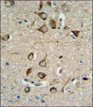 ANTI-ASMT (CENTER) antibody produced in rabbit IgG fraction of antiserum, buffered aqueous solution