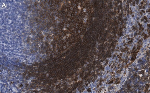 Anti-p-ZAP-70 (Tyr319) Antibody, clone 1B10 ZooMAb&#174; Rabbit Monoclonal recombinant, expressed in HEK 293 cells