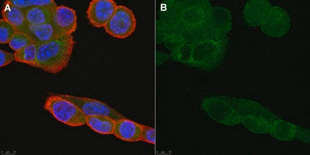 Anti-CD36 Antibody, clone ZND36-6