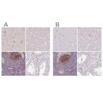 抗TMEM119 ウサギ宿主抗体 Prestige Antibodies&#174; Powered by Atlas Antibodies, affinity isolated antibody, buffered aqueous glycerol solution