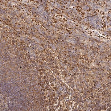 Anti-FGF21 antibody produced in rabbit Prestige Antibodies&#174; Powered by Atlas Antibodies, affinity isolated antibody, buffered aqueous glycerol solution