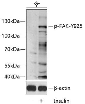 Anti-Phospho-FAK-Y925 antibody produced in rabbit