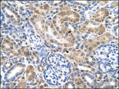 Anti-SLC22A3 affinity isolated antibody