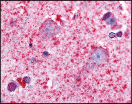 Anti-HTR7 (AB1) antibody produced in rabbit affinity isolated antibody, buffered aqueous solution