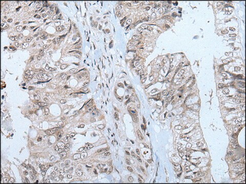 Anti-MTHFR affinity isolated antibody