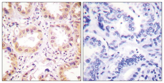 Anti-NEDD8 antibody produced in rabbit affinity isolated antibody