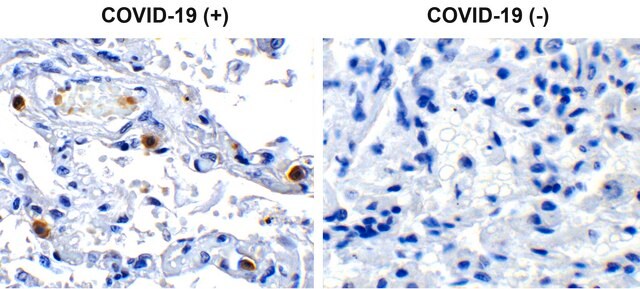 Anti-SARS-CoV-2 (COVID-19) NSP16 antibody produced in rabbit affinity isolated antibody