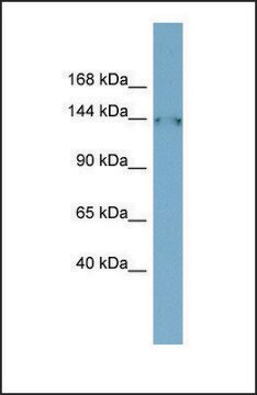 Anti-FAM135B antibody produced in rabbit affinity isolated antibody