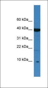 Anti-SPINK6 antibody produced in rabbit affinity isolated antibody