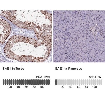 Anti-SAE1 antibody produced in rabbit Prestige Antibodies&#174; Powered by Atlas Antibodies, affinity isolated antibody, buffered aqueous glycerol solution