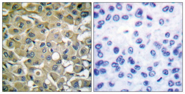 Anti-Keratin 18 antibody produced in rabbit affinity isolated antibody