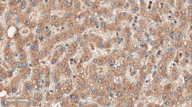 Anti-FMO3 Antibody serum, from rabbit