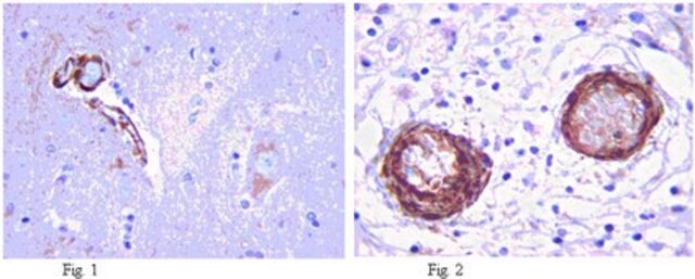 Anti-LRRK2 Antibody, clone N138/6 clone N138/6, from mouse