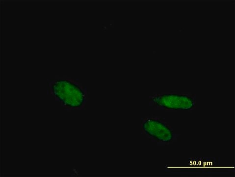 Anti-VDR antibody produced in mouse purified immunoglobulin, buffered aqueous solution