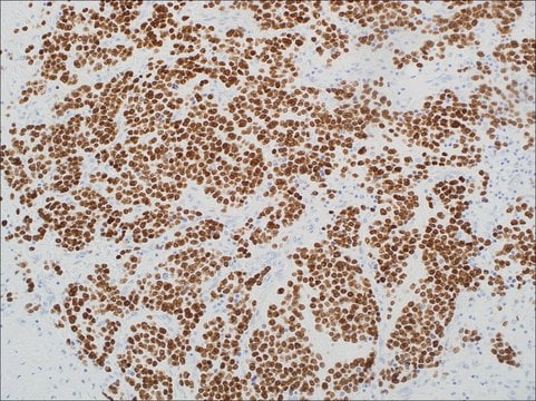 PHOX2B (EP312) Rabbit Monoclonal Primary Antibody