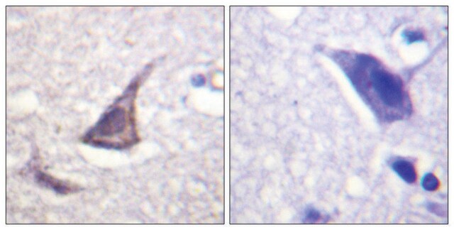 Anti-Calcium Sensing Receptor antibody produced in rabbit affinity isolated antibody