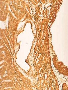 Anti-Nitrotyrosine Antibody, clone 1A6 clone 1A6, Upstate&#174;, from mouse