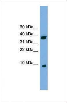 Anti-RPS21 antibody produced in rabbit affinity isolated antibody