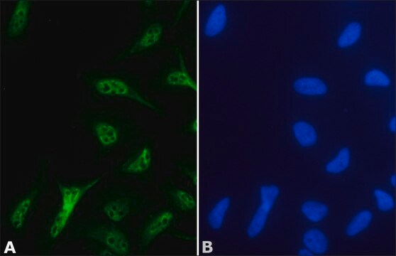 Anti-Supervillin antibody produced in rabbit affinity isolated antibody, buffered aqueous solution